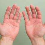 Ihre Hände wissen mehr, als Sie denken: Was Finger, Schwellungen und trockene Haut über Ihr Wohlbefinden verraten können